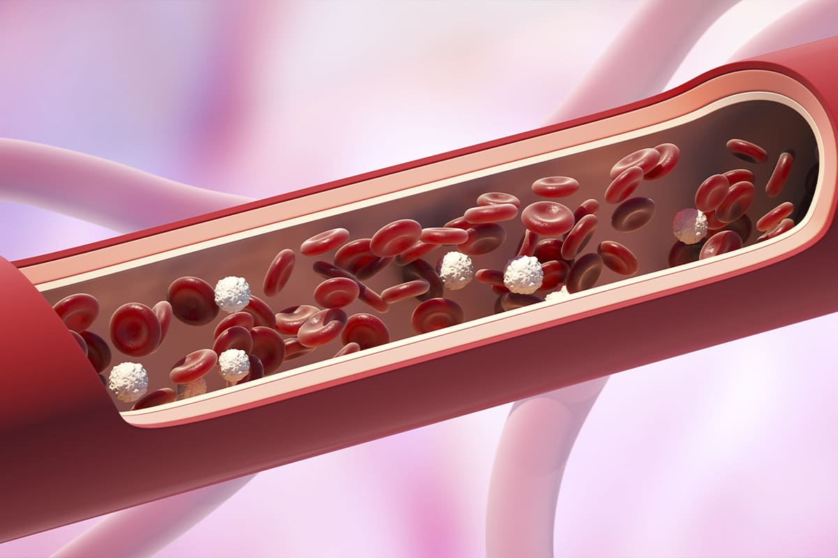 Hemodinamia