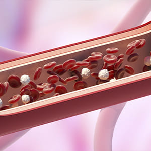 hemodinamia